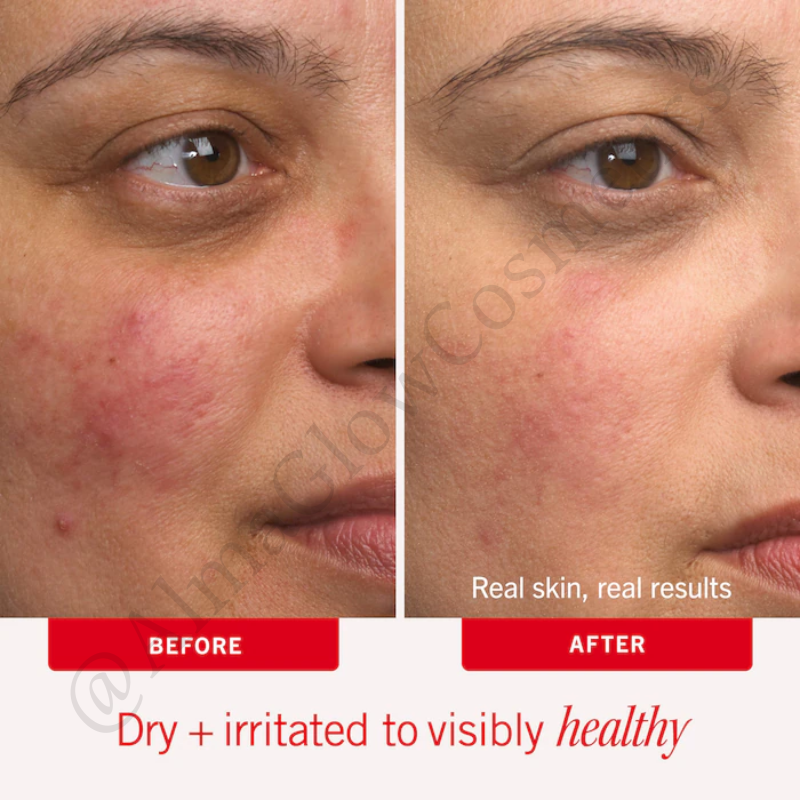 Ultra Repair Cream Intense Hydration 6OZ (FIRST AID BEAUTY)
