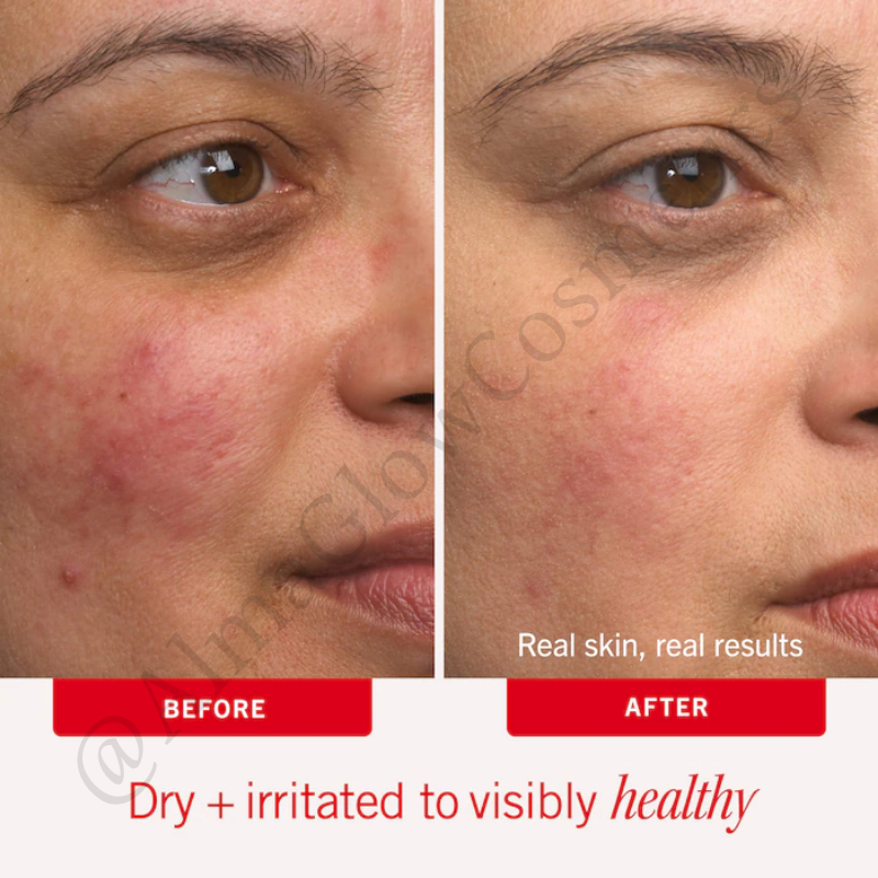 Ultra Repair Cream Intense Hydration (FIRST AID BEAUTY)