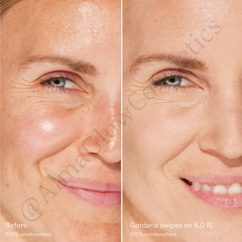 Swipe All-Over Hydrating Serum Concealer