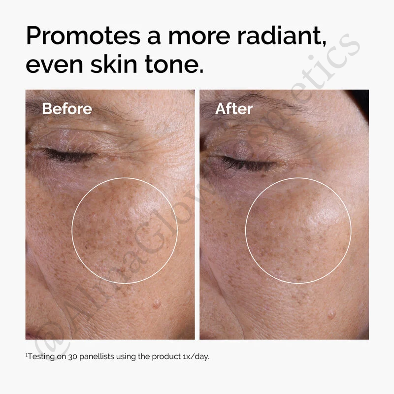 Ácido Glicólico (The Ordinary)