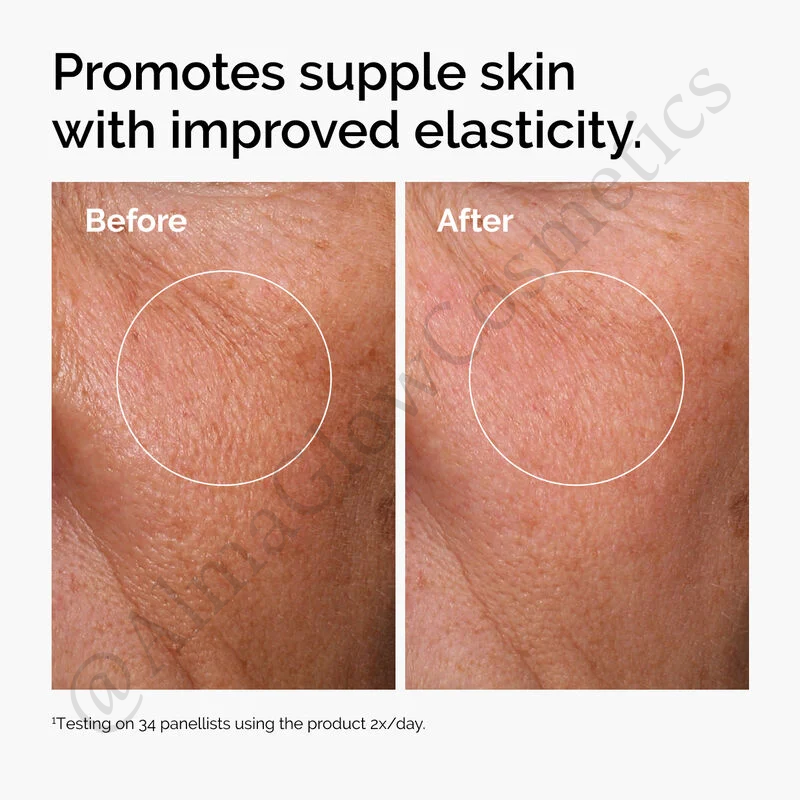 Ácido hialurónico (The Ordinary)