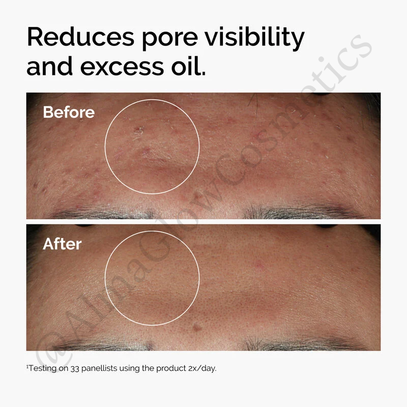 Niacinamida (The Ordinary) 30ML
